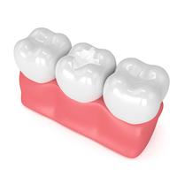 White fillings Dentist in Peacehaven and Newhaven